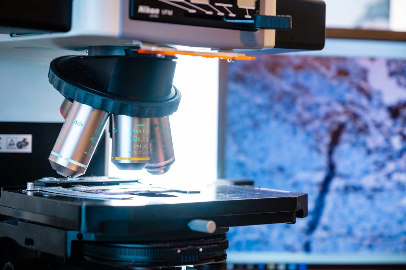 Microscope lenses